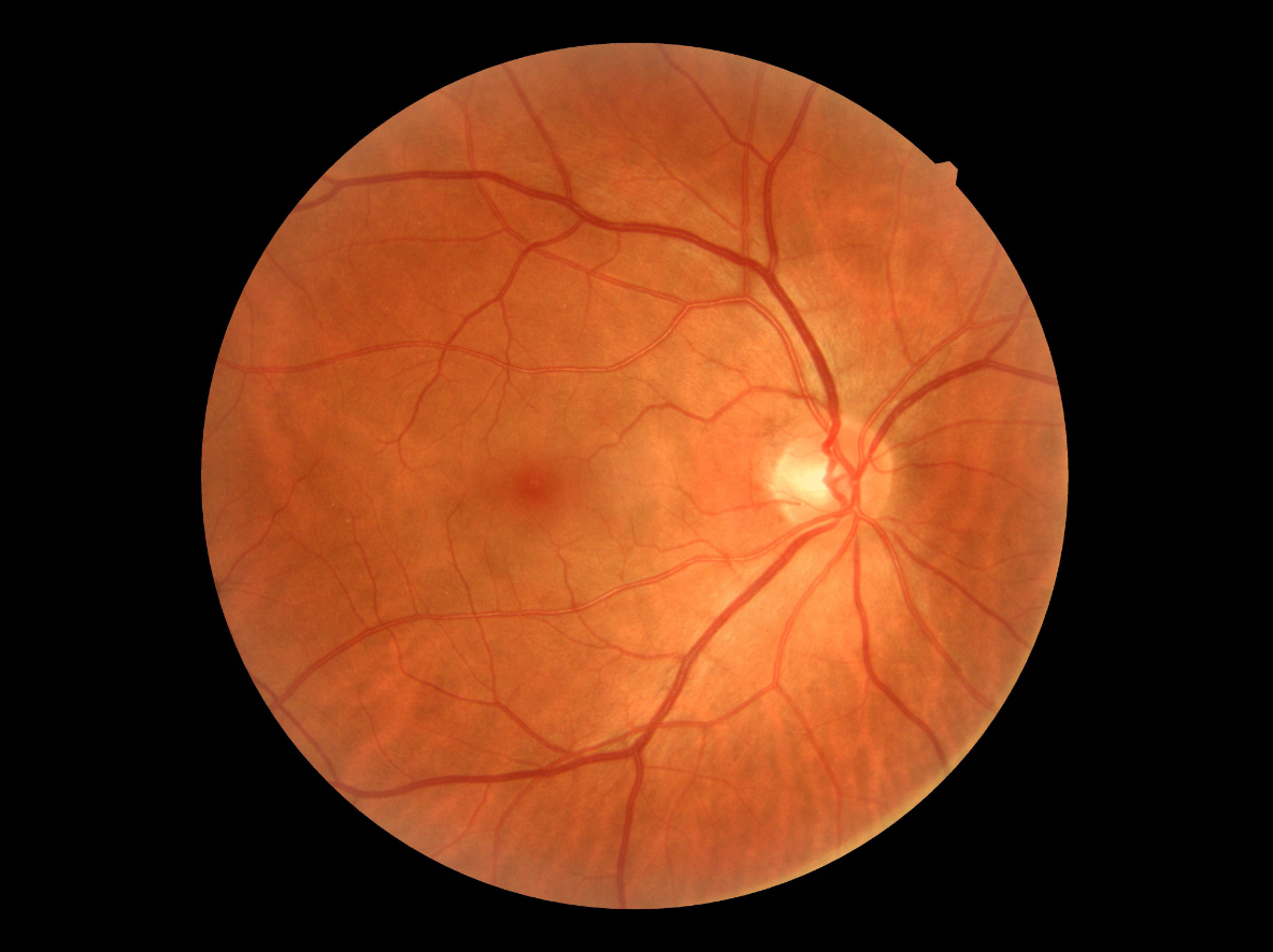 La cámara retiniana Crystalvue NFC-600 captura imágenes retinales de alta calidad