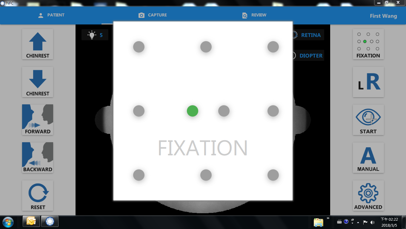 Crystalvue fundus camera provides 10 Selectable Fixation Targets