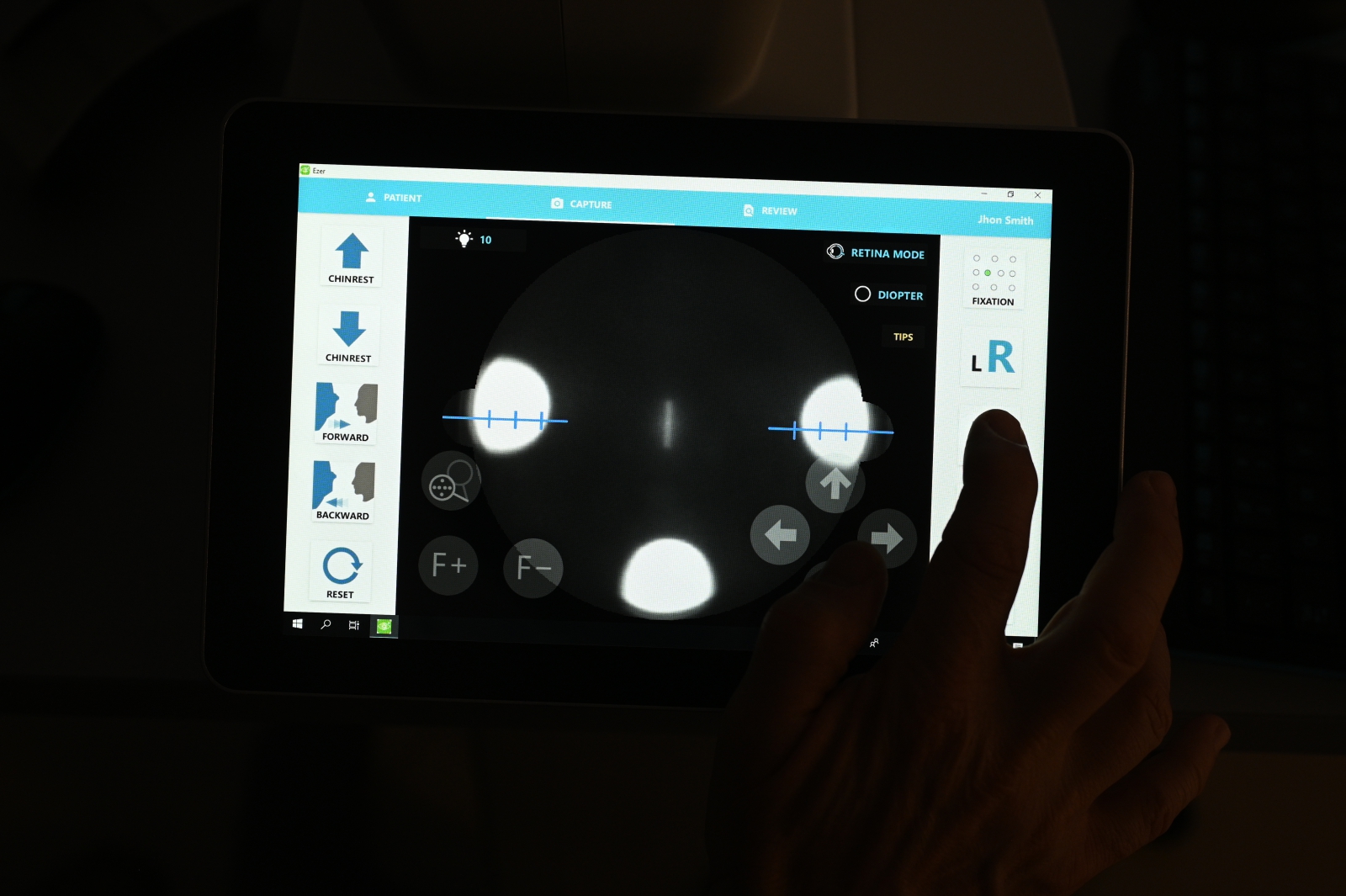 NFC-700 can capture cornea images for doctor to examine the cornea, iris, ciliary body and sclera.
