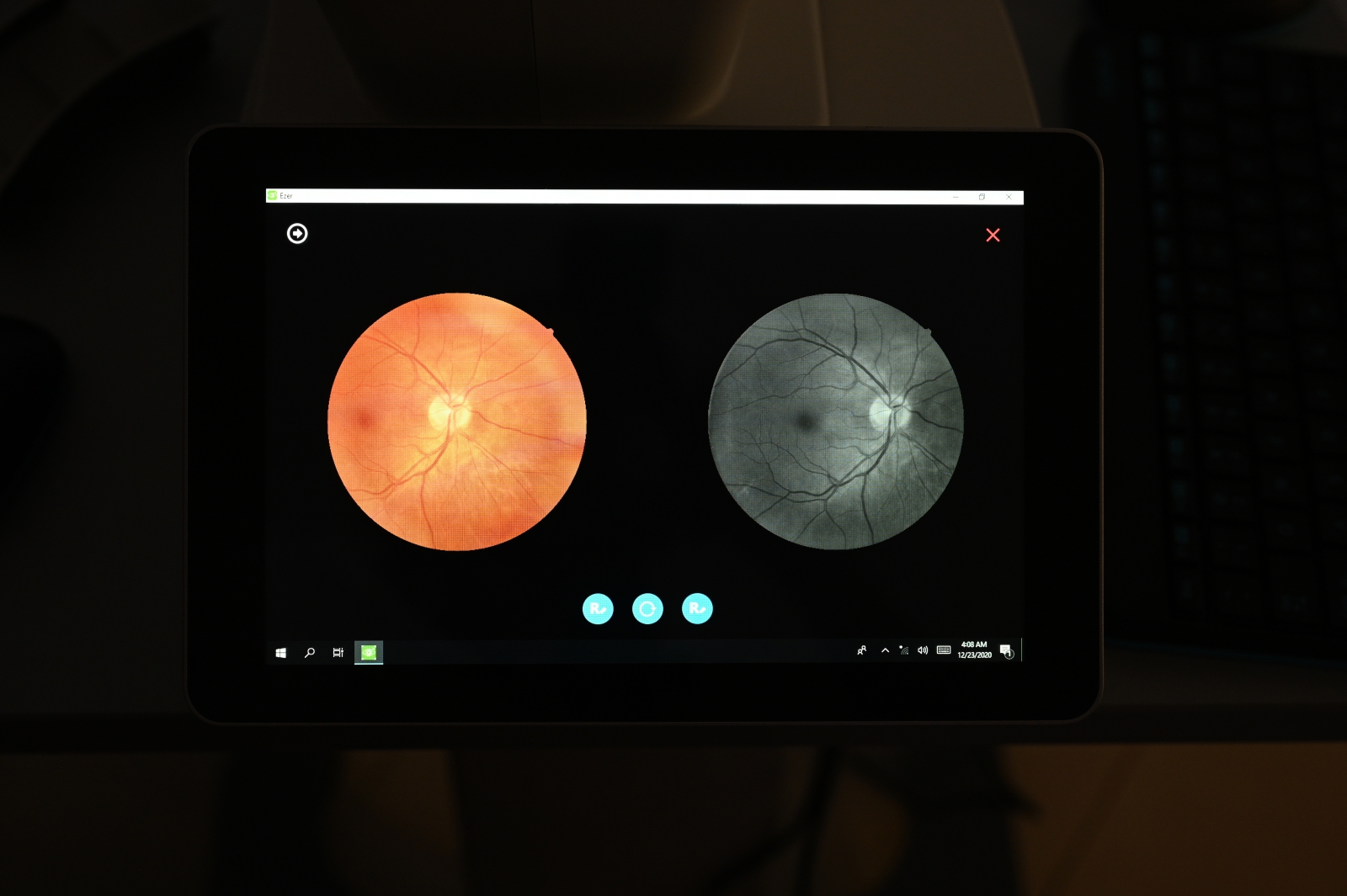 Crystalvue NFC-700-Retinal Image Comparisons