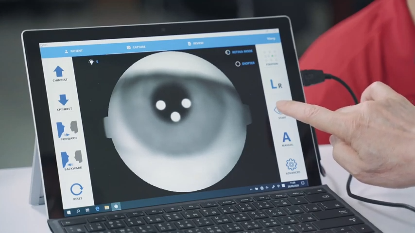 明達醫學NFC-600眼底攝影機操作介面設計清晰友善