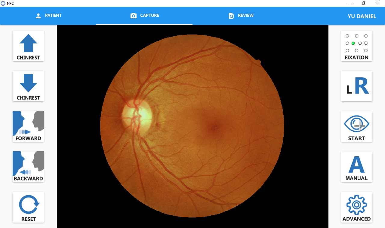 Crystalvue NFC-700 fundus camera is equipped with Large 10.1” Touch Screen