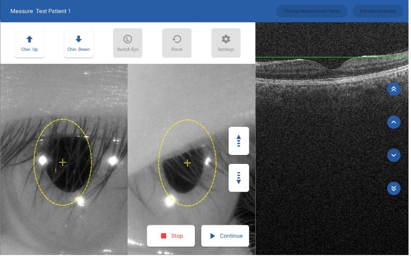 明達醫學眼底照相機支援手動對焦與眼角膜拍攝